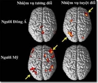 Văn h&oacute;a ảnh hưởng đến chức năng của n&atilde;o